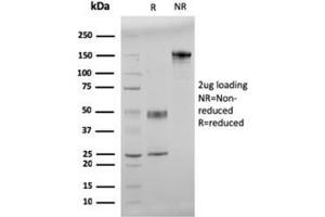 SDS-PAGE Analysis Purified Double Stranded DNA Mouse Monoclonal Antibody (121-3). (dsDNA 抗体)