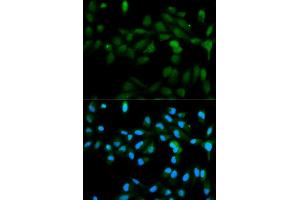 Immunofluorescence analysis of MCF7 cell using CYP11A1 antibody. (CYP11A1 抗体  (AA 40-320))
