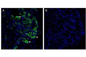 Expression of GPR35 in rat dorsal root ganglion. (GPR35 抗体  (Extracellular))