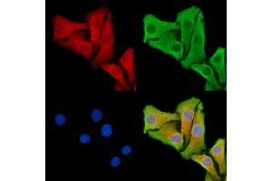 ABIN7095318 and ABIN7099375 staining Hela cells by IF/ICC. (SNX33 抗体)