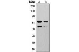 Western blot analysis of MMP10 expression in HepG2 (A), NIH3T3 (B) whole cell lysates. (MMP10 抗体  (Center))