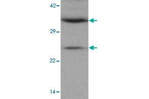 Western blot analysis of CXXC5 in human brain tissue lysate with CXXC5 polyclonal antibody  at 1 ug/mL. (CXXC5 抗体  (N-Term))