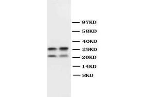 Anti-Myelin Basic Protein antibody, Western blotting WB: Mouse Brain Tissue Lysate (MBP 抗体  (C-Term))