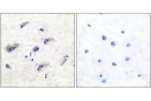 Immunohistochemistry (IHC) image for anti-Microtubule-Associated Protein tau (MAPT) (pSer356) antibody (ABIN2888546) (MAPT 抗体  (pSer356))