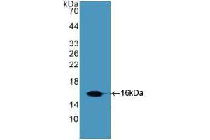 Western blot analysis of recombinant Human Slit2. (SLIT2 抗体  (AA 1416-1528))