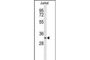 Western blot analysis of T150A Antibody (Center) (ABIN653313 and ABIN2842808) in Jurkat cell line lysates (35 μg/lane). (TMEM150A 抗体  (AA 81-108))