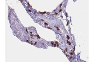 ABIN6267424 at 1/100 staining human lung tissue sections by IHC-P. (ELK1 抗体  (pSer389))