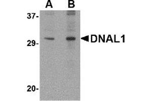 Western Blotting (WB) image for anti-Dynein, Axonemal, Light Chain 1 (DNAL1) (C-Term) antibody (ABIN1030363) (DNAL1 抗体  (C-Term))