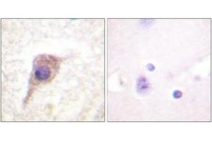 Immunohistochemistry analysis of paraffin-embedded human brain, using PKC zeta (Phospho-Thr560) Antibody. (PKC zeta 抗体  (pThr560))