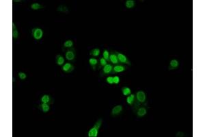 Immunofluorescence staining of PC-3 cells with ABIN7152540 at 1:100, counter-stained with DAPI. (FANCB 抗体  (AA 431-574))