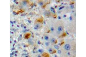 Used in DAB staining on fromalin fixed paraffin-embedded Liver tissue (DCL1 抗体  (AA 23-232))