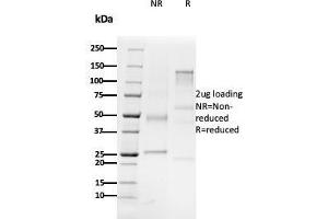 SDS-PAGE Analysis Purified CD79b Mouse Monoclonal Antibody (B29/123). (CD79b 抗体  (C-Term))