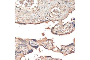 Immunohistochemistry of paraffin-embedded human placenta using MSP/MST1 antibody (ABIN6132374, ABIN6144095, ABIN6144096 and ABIN6216790) at dilution of 1:200 (40x lens).