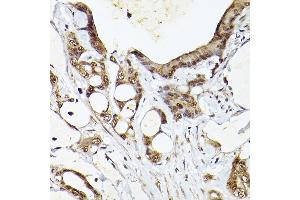 Immunohistochemistry of paraffin-embedded human colon carcinoma using UBQLN4 Rabbit pAb (ABIN7271124) at dilution of 1:150 (40x lens). (UBQLN4 抗体  (AA 300-390))