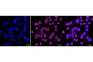 anti-Heterogeneous Nuclear Ribonucleoprotein U (Scaffold Attachment Factor A) (HNRNPU) antibody