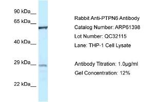 Western Blotting (WB) image for anti-Protein-tyrosine Phosphatase 1C (PTPN6) (Middle Region) antibody (ABIN2788789) (SHP1 抗体  (Middle Region))