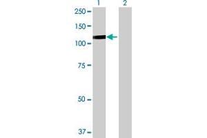 Western Blot analysis of DDX54 expression in transfected 293T cell line by DDX54 MaxPab polyclonal antibody. (DDX54 抗体  (AA 1-881))