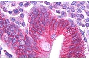 Immunohistochemistry (IHC) image for anti-ATPase, Na+/K+ Transporting, beta 1 Polypeptide (ATP1B1) (Internal Region) antibody (ABIN571055)