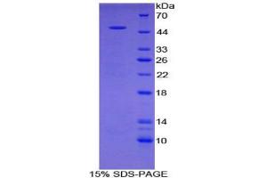 SDS-PAGE analysis of Rat PRG2 Protein. (Major Basic Protein 蛋白)