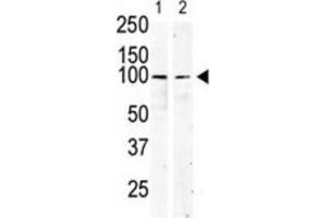 Western Blotting (WB) image for anti-Mast/stem Cell Growth Factor Receptor (KIT) antibody (ABIN5014921) (KIT 抗体)