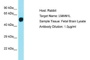 Host: Rabbit Target Name: LMAN1L Sample Tissue: Human Fetal Brain Antibody Dilution: 1ug/ml (LMAN1L 抗体  (Middle Region))