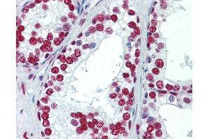 Anti-SAE1 antibody IHC staining of human prostate. (SAE1 抗体)