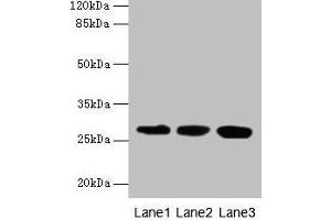 Western blot All lanes: KHDC1 antibody at 5 μg/mL Lane 1: Mouse liver tissue Lane 2: Mouse kidney tissue Lane 3: Mouse gonadal tissue Secondary Goat polyclonal to rabbit IgG at 1/10000 dilution Predicted band size: 28, 19 kDa Observed band size: 28 kDa (KHDC1 抗体  (AA 74-237))