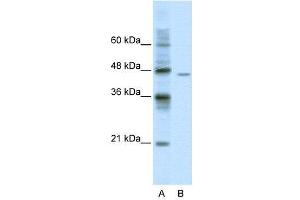 WB Suggested Anti-DDX25  Antibody Titration: 0. (DDX25 抗体  (C-Term))