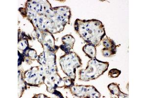 Anti-EIF2S1 antibody, IHC(P) IHC(P): Human Placenta Tissue