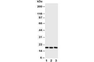 Western blot testing of I-309 antibody and Lane 1:  SCG;  2: COLO320;  3: Jurkat cell lysate.