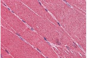 Human Skeletal Muscle: Formalin-Fixed, Paraffin-Embedded (FFPE) (EDEM2 抗体  (AA 479-579))