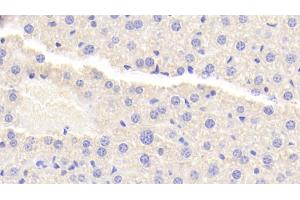 Detection of TNIP2 in Mouse Liver Tissue using Polyclonal Antibody to Tumor Necrosis Factor Alpha Induced Protein 3 Interacting Protein 2 (TNIP2) (TNIP2 抗体  (AA 170-413))
