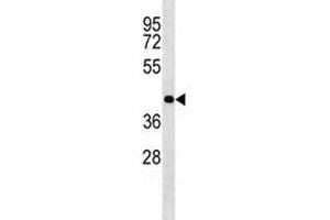 Western Blotting (WB) image for anti-Oligodendrocyte Lineage Transcription Factor 2 (OLIG2) (AA 152-180) antibody (ABIN3032092)