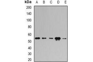 Western blot analysis of E3BP expression in HepG2 (A), MCF7 (B), mouse testis (C), mouse brain (D), rat kidney (E) whole cell lysates.