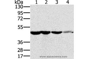 Western blot analysis of HT-29 cell and human normal kidney tissue, Lo2 cell and human normal liver tissue, human fetal brain tissue, using RNH1 Polyclonal Antibody at dilution of 1:400 (RNH1 抗体)