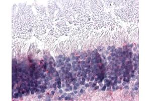 Immunohistochemistry (IHC) image for anti-Nuclear Receptor Subfamily 2, Group E, Member 3 (NR2E3) (Ligand Binding Domain) antibody (ABIN1049137)
