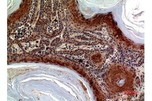 Immunohistochemical analysis of paraffin-embedded human-skin, antibody was diluted at 1:100 (CCL27 抗体  (Internal Region))