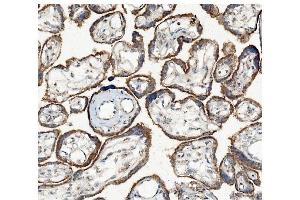 IHC analysis of Hexokinase 1/HK1 using anti-Hexokinase 1/HK1 antibody (ABIN7600259).