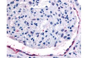 Anti-EPHA4 antibody IHC of human kidney, glomerulus. (EPH Receptor A4 抗体  (Internal Region))