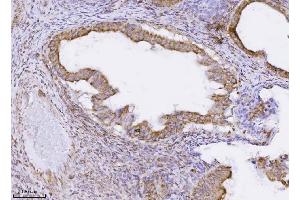 IHC analysis of PMPCB using anti-PMPCB antibody (ABIN7600757). (PMPCB 抗体  (AA 23-479))