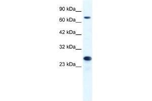 WB Suggested Anti-MCM6 Antibody Titration:  1. (MCM6 抗体  (C-Term))