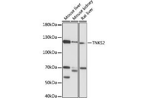 Western blot analysis of extracts of various cell lines, using TNKS2 antibody (ABIN7270726) at 1:1000 dilution.