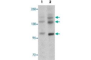 Western blot analysis of rat brain tissue with PRDM16 polyclonal antibody  at (Lane 1) 1 and (Lane 2) 2 ug/mL dilution. (PRDM16 抗体  (C-Term))