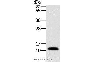 Western blot analysis of Human prostate tissue, using MSMB Polyclonal Antibody at dilution of 1:250 (MSMB 抗体)