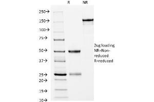 SDS-PAGE Analysis Purified HLA-DRB Mouse Monoclonal Antibody (L243). (HLA-DRB1 抗体)