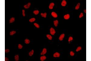 anti-Bromodomain Containing 2 (BRD2) (AA 675-725) antibody