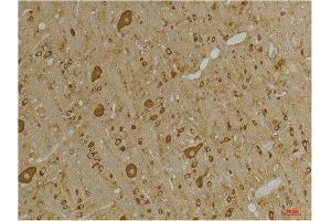 Immunohistochemistry (IHC) analysis of paraffin-embedded Rat Brain Tissue using GABA A Receptor gamma2 Rabbit Polyclonal Antibody diluted at 1:200. (GABRG2 抗体)