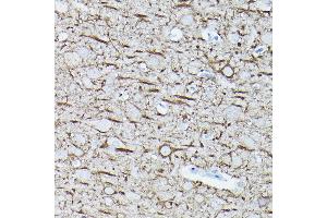 Immunohistochemistry (IHC) image for anti-Neurofilament, Light Polypeptide (NEFL) antibody (ABIN7268867)