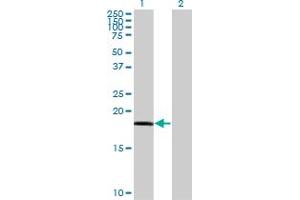 Western Blot analysis of RARRES3 expression in transfected 293T cell line by RARRES3 monoclonal antibody (M10), clone 1H5.