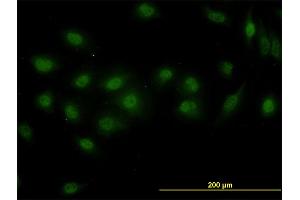 Immunofluorescence of monoclonal antibody to DPF2 on HeLa cell. (DPF2 抗体  (AA 56-155))